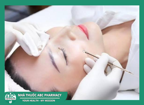 Nên Trị Mụn Tại Spa Hay Phòng Khám Da Liễu? 